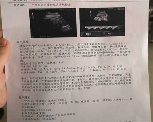 中国助孕机构排名_准妈妈如何预防水肿和高血压