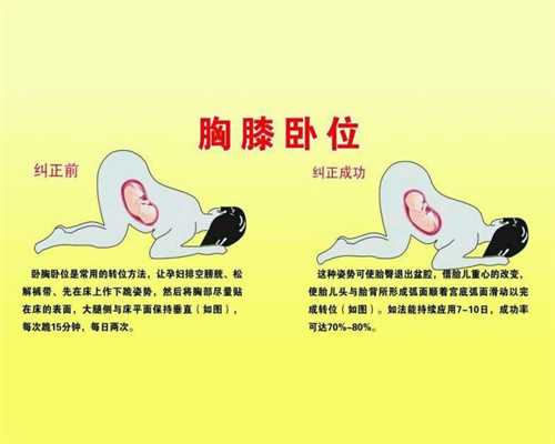 中国正规的助孕机构_孕妇生产大出血的原因是什
