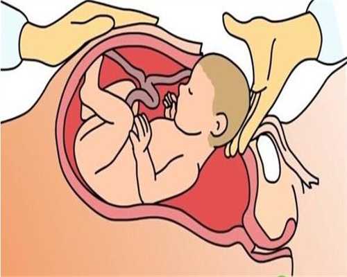 代孕有什么要求_怀孕初期能不能吃驴肉