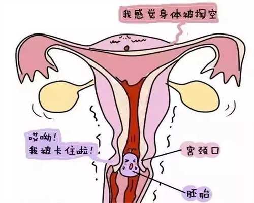 代孕辅助生殖中心怎么样_减轻孕吐的方法