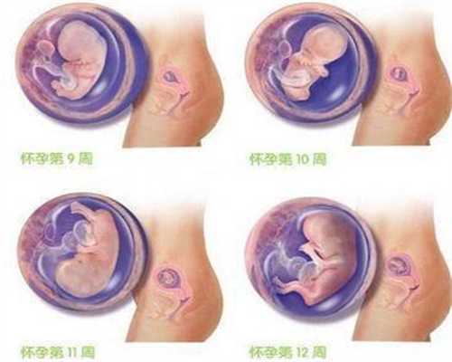 试管婴儿代孕是合法的吗_哪些孕妇容易宫缩频繁，日常生活中如何预防宫缩