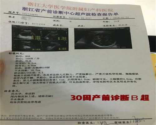 最新 代孕QQ群_如何避免婴儿猝死综合症